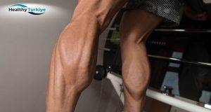 A Guide to Achieving Defined Calves with Implants in Turkey